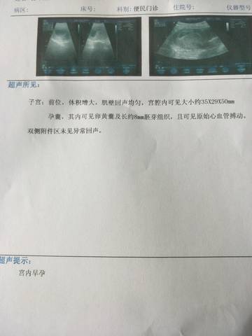 journal_insert_pic_971873427