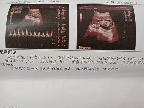 journal_insert_pic_973157463
