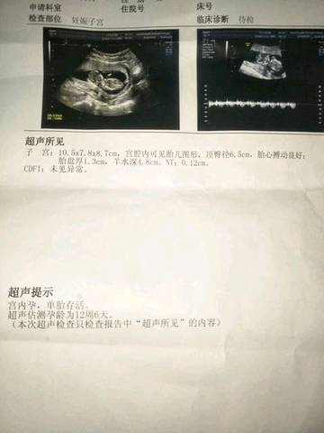 journal_insert_pic_975398814