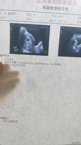 journal_insert_pic_976980646
