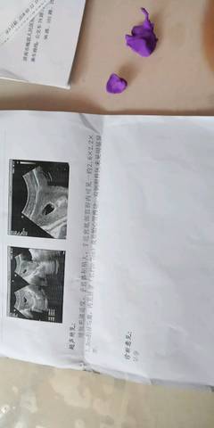 journal_insert_pic_977577513
