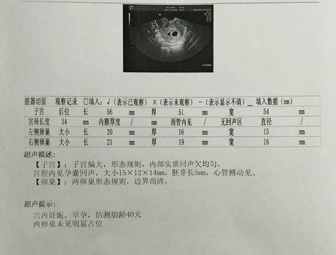 journal_insert_pic_977564281