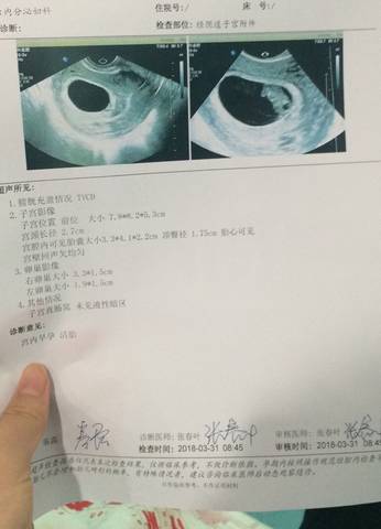 journal_insert_pic_979047746