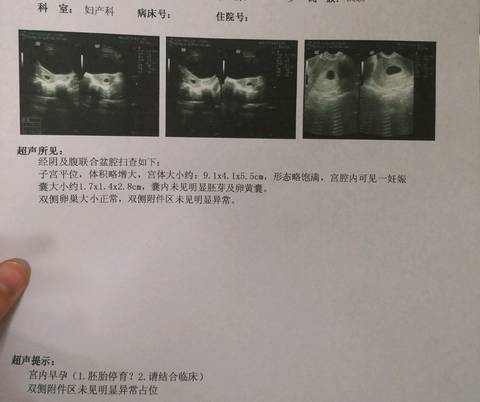 journal_insert_pic_980913368