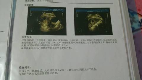 journal_insert_pic_985164580