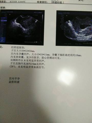 journal_insert_pic_986163512