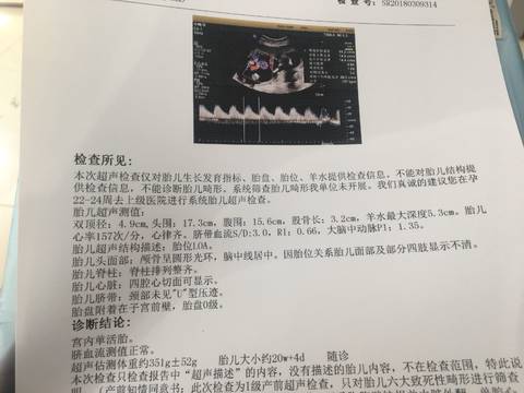 journal_insert_pic_986868985
