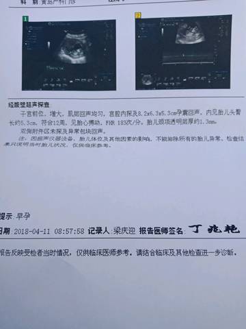 journal_insert_pic_987271745