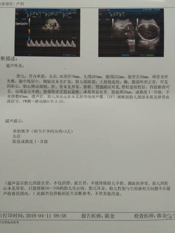 journal_insert_pic_987321070