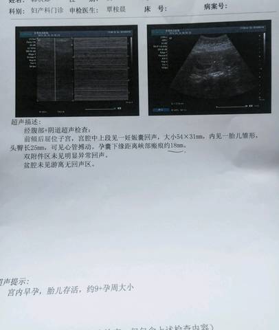 journal_insert_pic_989564355