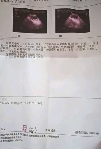 journal_insert_pic_990222410