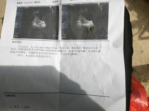 journal_insert_pic_990951360