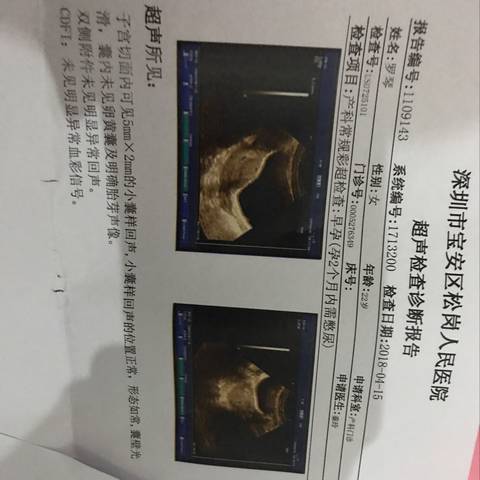 journal_insert_pic_991365094