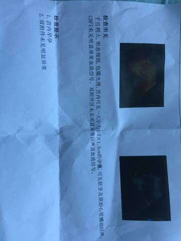 journal_insert_pic_991909621