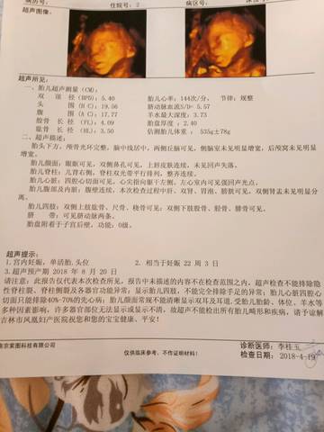 journal_insert_pic_993018232