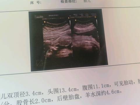 journal_insert_pic_993894605