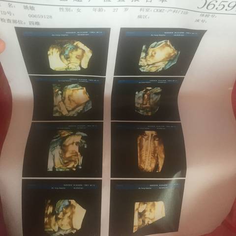 journal_insert_pic_994949841