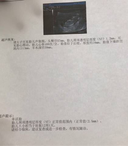 journal_insert_pic_995420510