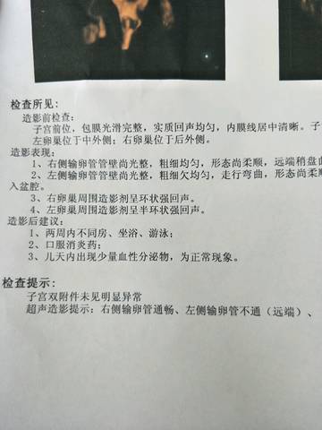 journal_insert_pic_997384433