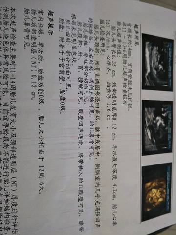 journal_insert_pic_998852821