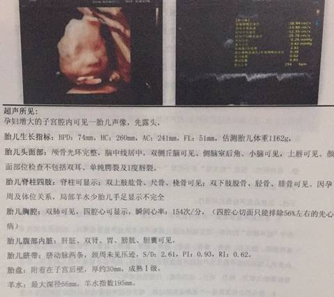 journal_insert_pic_998854399