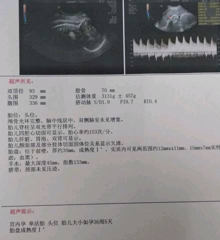 journal_insert_pic_1000380662