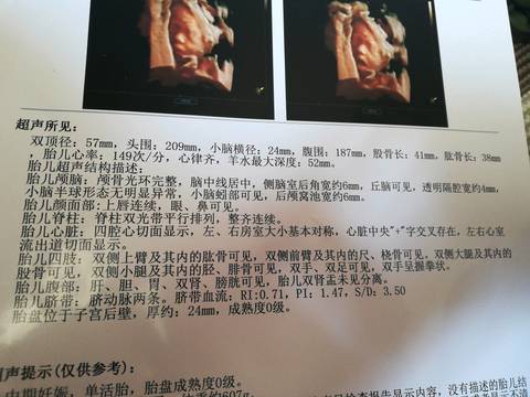 journal_insert_pic_1000167870
