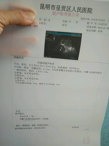 journal_insert_pic_1000180258