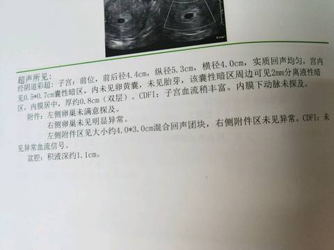 journal_insert_pic_1002770608