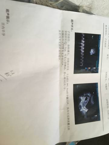 journal_insert_pic_1002606182