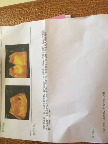 journal_insert_pic_1003371670
