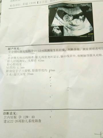 journal_insert_pic_1004072576
