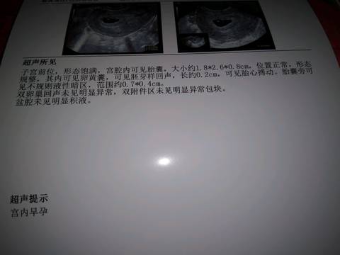 journal_insert_pic_1004333297
