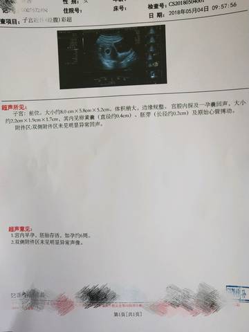 journal_insert_pic_1004420569