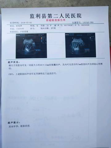 journal_insert_pic_1004799709