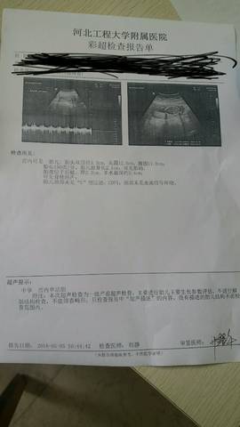 journal_insert_pic_1004863189