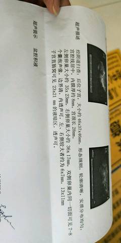 journal_insert_pic_1004971345