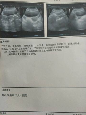 journal_insert_pic_1005566866