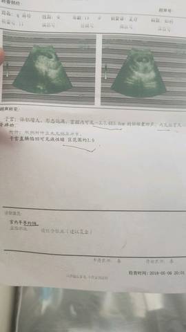journal_insert_pic_1006369241