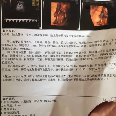 journal_insert_pic_1008581213