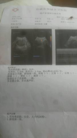 journal_insert_pic_1009499975