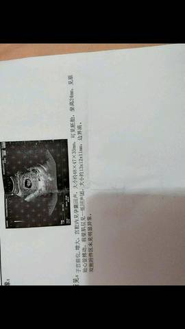 journal_insert_pic_1012033745