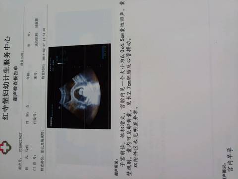journal_insert_pic_1012846109