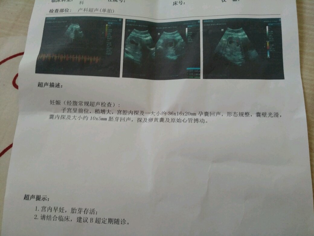 【新手报到】停经两个月终于b超看到胎芽胎心了