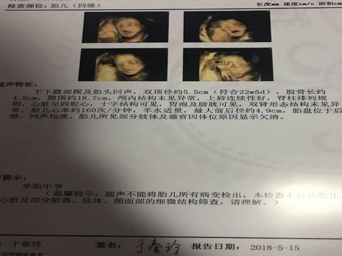 journal_insert_pic_1013782140
