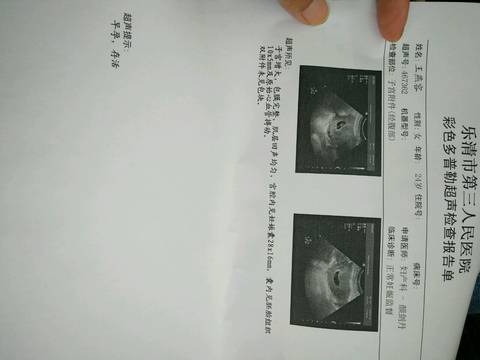 journal_insert_pic_1015600451