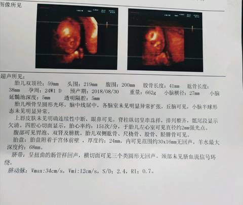 journal_insert_pic_1021115772