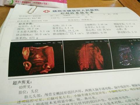 journal_insert_pic_1021310465