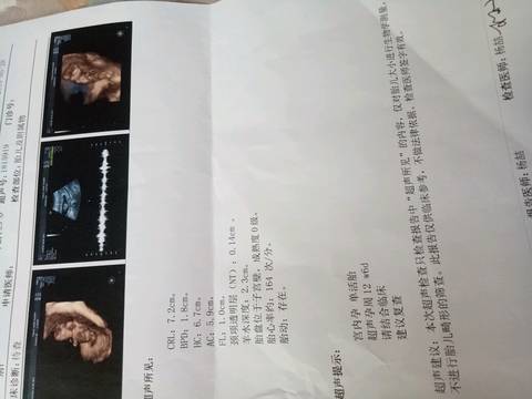 journal_insert_pic_1022051926