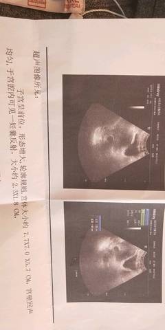 journal_insert_pic_1022497049